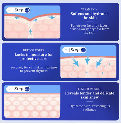 40% Urea Repair Cream: Fast Relief for Dry, Cracked Skin & Calluses