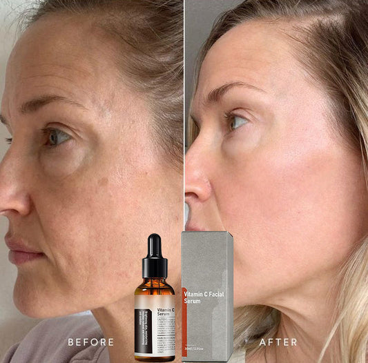 【Dermatologist-Recommended】 VC Spot-Correction & Whitening Cream Set-50%OFF