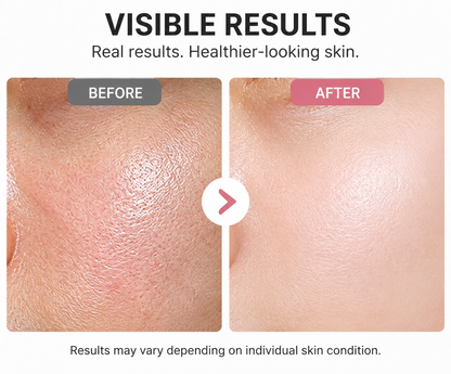 5% Urea Moisture Boost Serum