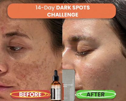 【Dermatologist-Recommended】 VC Spot-Correction & Whitening Cream Set-50%OFF