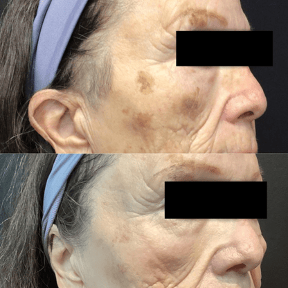 SILK-WHITE Radiance Renewal Cream