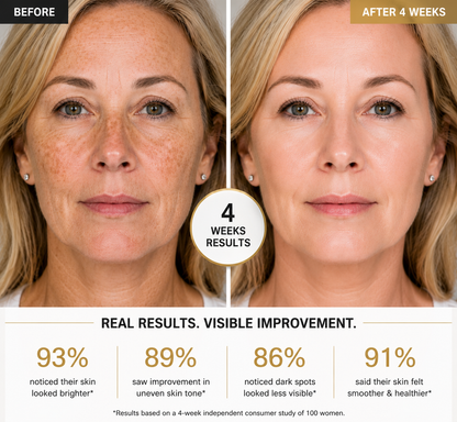 SILK-WHITE Radiance Renewal Cream