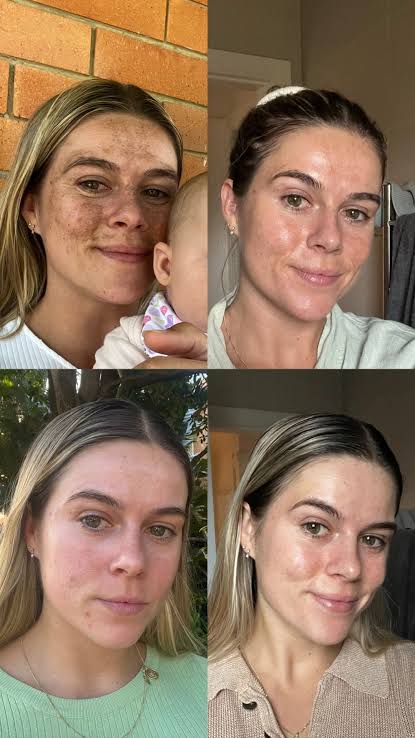 BIBZIZ™️ NMN-Powered Anti-Aging Cream & Lotion