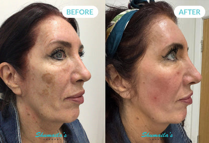 BIBZIZ™️ NMN-Powered Anti-Aging Cream